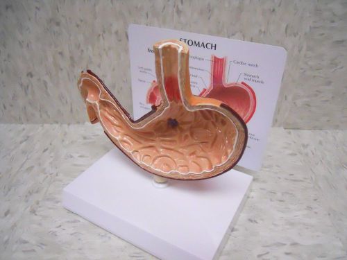 Stomach Anatomical Model w Ulcer with Key Card LFA #2000 **