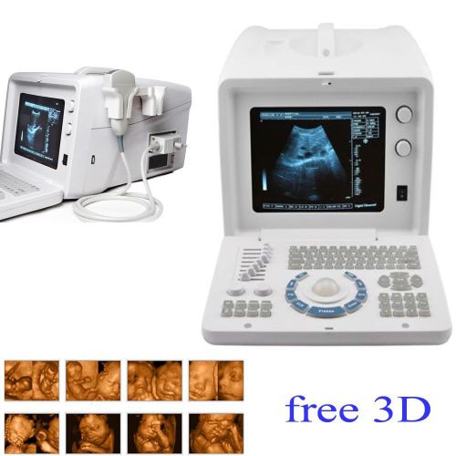 AA+ Portable Digital Ultrasound Machine Scanner System Convex Probe + extrnal 3D