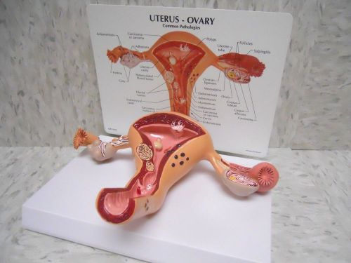 Uterus Ovary Anatomical Model Anatomy Cross-Section with Key Card LFA #3480 **