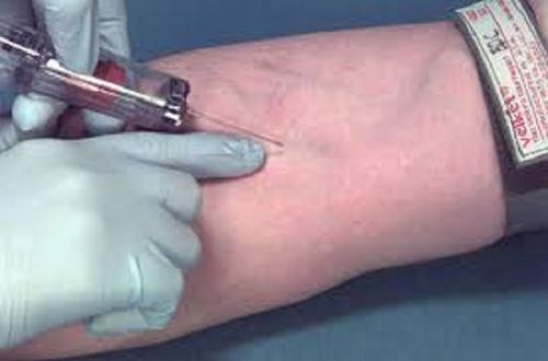 Venipunture and Phlebotomy ...The art of taking blood 1 Video DVD