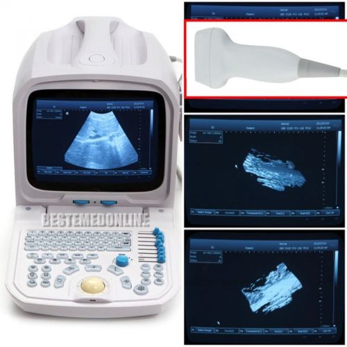 Ce+fda 10&#034; pc platform built_in 3d ultrasound machine scanner&amp;linear probe ca for sale