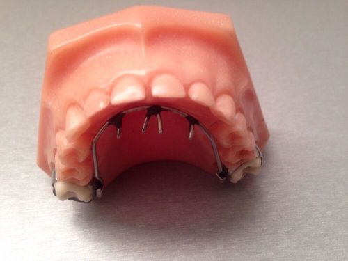 Pediatric Dentistry Dental Tongue Thrusting Appliance Model