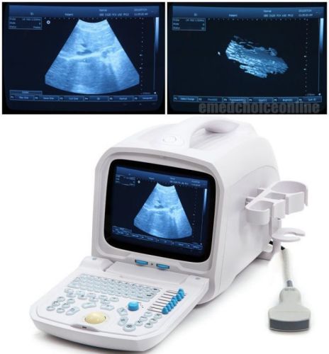 Ce pc platform full digital portable ultrasound scanner machine+convex probe ca for sale