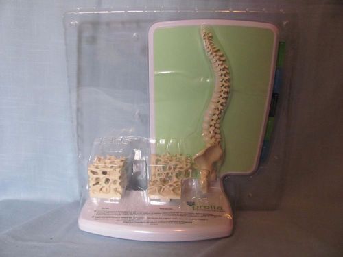 HUMAN SPINE Medical MODEL w Book for Prolia Dr. Office Use for Osteoporosis