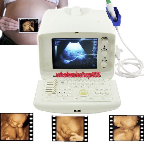 Dynamic full digital portable ultrasound scanner+ convex probe + 3d work station for sale