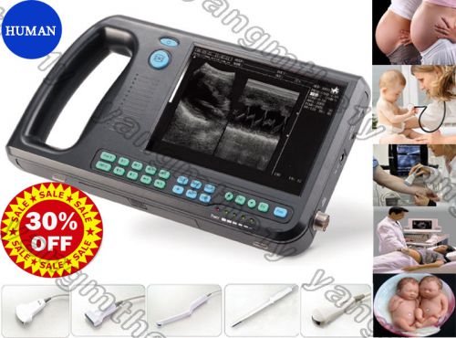 Human palm smart b-ultrasound ultrasound scanner system + 3.5mhz convex probe for sale