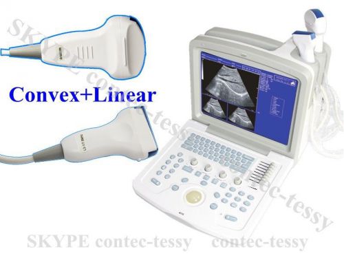 Contec CMS600B-3 Digital Portable Ultrasound Scanner+2 probes(CONVEX+LINEAR)
