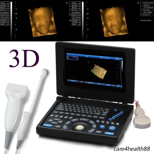 3d pc full-digital ultrasound scanner machine 3.5mhz convex + linear+ tvaginal for sale