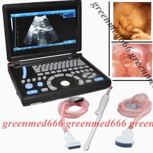 Hd pc platform 3d laptop ultrasound scanner with 3 probes(convex+linear+tv) for sale