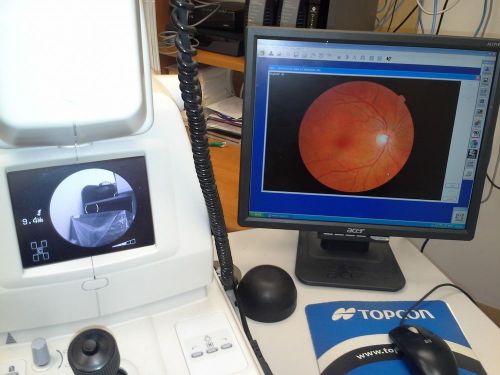 Topcon TRC-NW6S Digital Fundus Camera Non-Mydriatic with working software and pc