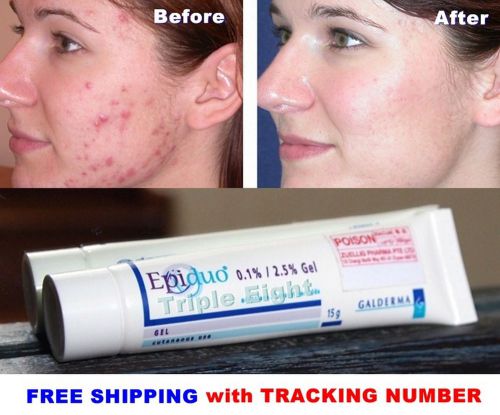 15g Gel for Acne Pimple Topical Acne Treatment
