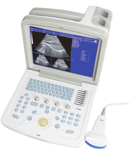 Ce high resolution ultrasound diagnostic system cms600b-3 + 3.5m convex probe for sale