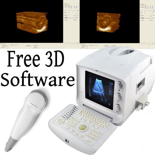 Portable digital ultrasound scanner micro convex probe 3d workstation ce for sale