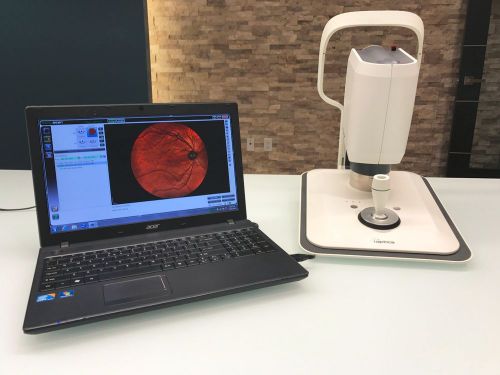 I-OPTICS EasyScan Retinal Imaging SLO Fundus Digital Camera with Acer Laptop
