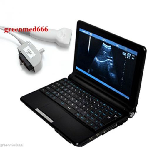 7.5MHz Linear Probe and New Full Digital Diagnostic System Ultrasound Scanner