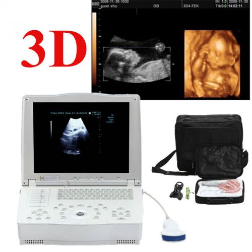 FDA 15-inch LCD Digital Laptop Ultrasound Scanner + convex probe 3D workstation