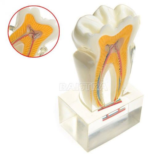 1 x New Dental 6:1 tooth study model teeth nerve anatomy anatomical model