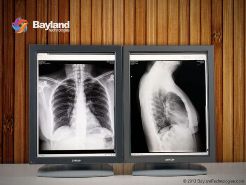 Pair (x2) Barco MFGD-3420 3MP Coronis Grayscale Medical LCD Monitors