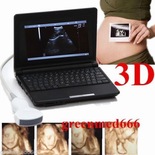 New Full Digital Diagnostic System Ultrasound Scanner +Convex Probe+3D