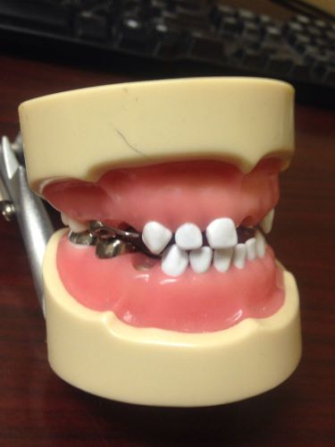 Nissin Pediatric Dentistry Dentoform Sscs And Spacers Model