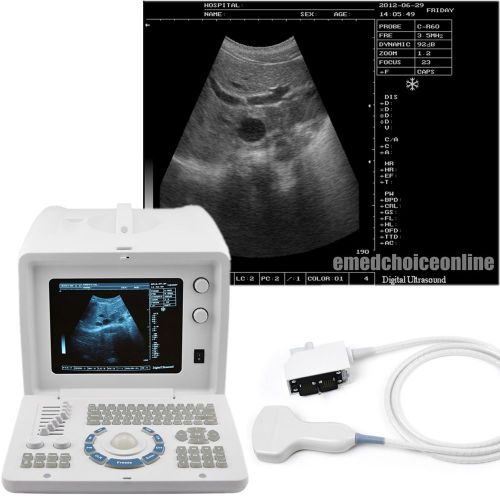 Veterinary vet ultrasound scanner with 3.5mhz convex probe +external 3d software for sale