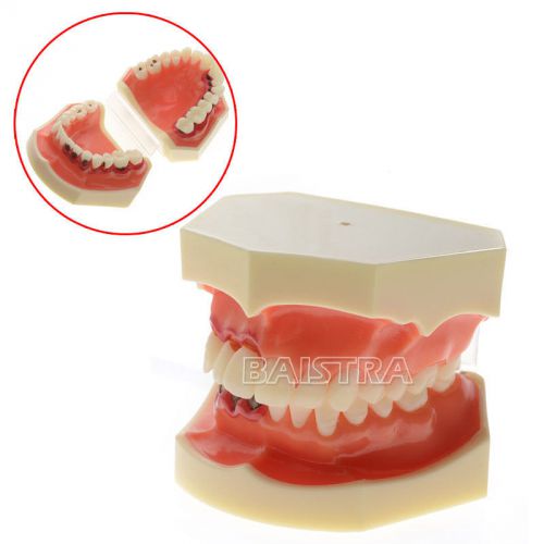 1PC New Dental Study Teeth Model Periodontal Periodontitis Disease ZYR 4003