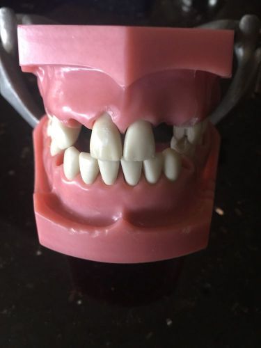 Dental Typodont Dentoform,150 extra teeth,1 has Dental Gold,many silver fillings