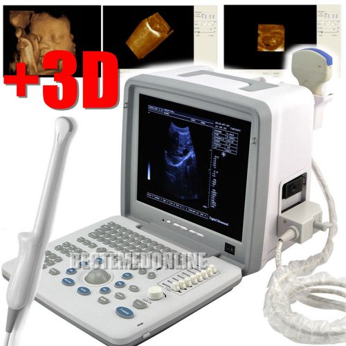 CE FDA New Full Digital Portable Ultrasound Scanner With Convex Vaginal Probe 3D