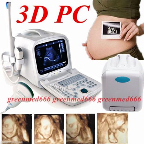 3D PC platform Ultrasound Scanner +3.5MHz Convex &amp;Transvaginal Probe Internet