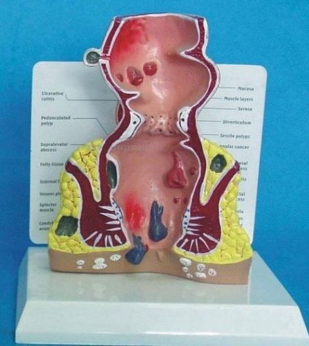 NEW Rectum Anatomical Model Colo-Rectal Anatomy 59