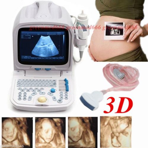 3d pc platform full digital portable ultrasound scanner machine +convex probe ce for sale