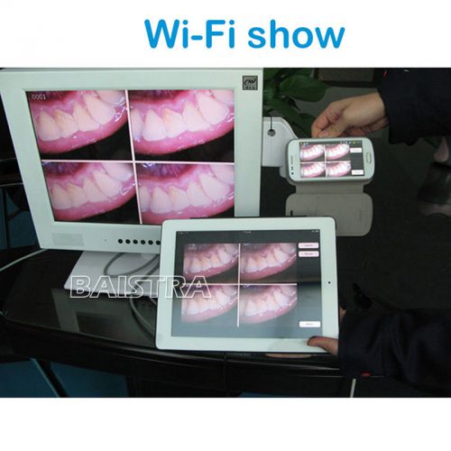 Dental Intra Oral Camera WI-FI super cam intraoral camera LCD screen DENTALJOY