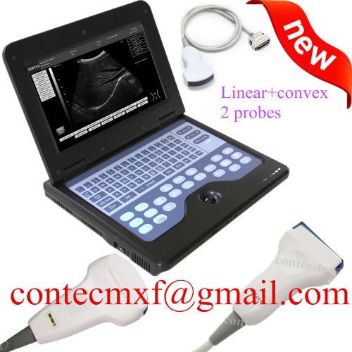 Digital Laptop Ultrasound scanner,LCD 10.1 inch,convex+linear probe,2y warranty