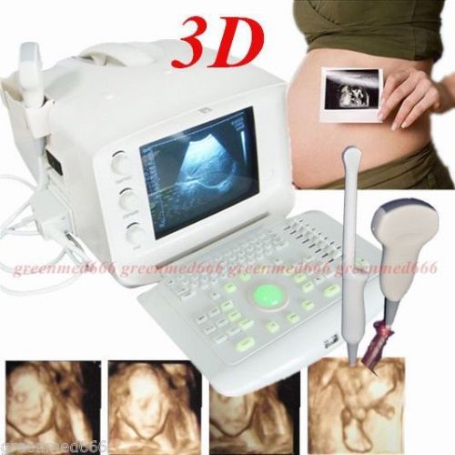 3D Digital Portable Ultrasound Scanner machine+CONVEX &amp;Transvaginal Probe FDA CE