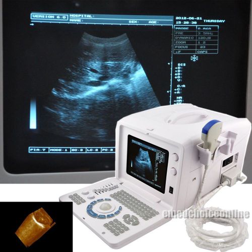 100% warranty 3d digital ultrasound machine scanner systerm with convex probe ce for sale