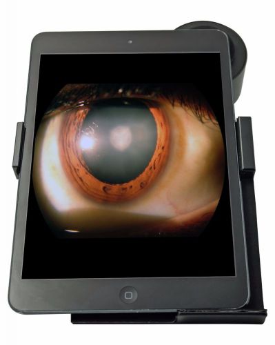 Hans Heiss Digital Eyepiece Adapter For Slit Lamp HDA003