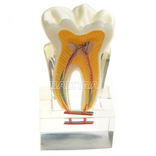 Dental 6:1 tooth study model teeth nerve anatomy anatomical model