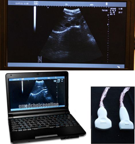 Ce full digital +3d laptop ultrasound scanner+** convex probes and linear probe for sale