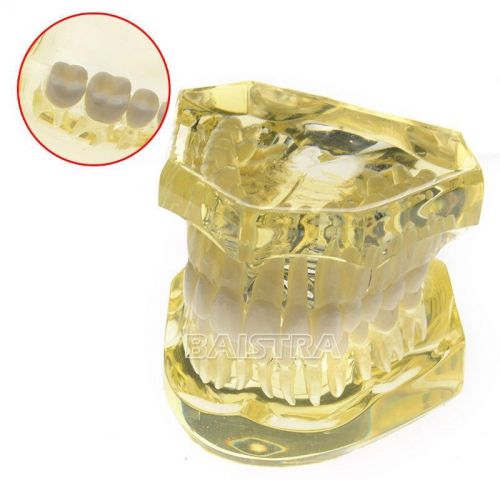 NEW 1 PC Dental Teeth Transparent Natural size Model Removable #7006-2