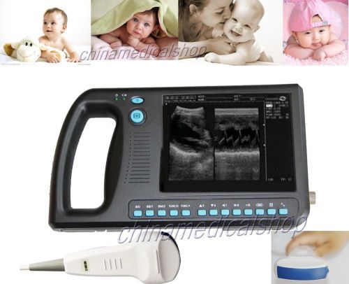 New palm smart b-ultrasound ultrasound scanner system + convex/abdominal probe for sale