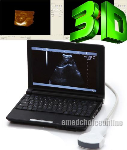 10&#039;&#039; Digital Laptop Notebook Ultrasound Scanner with Convex Probe 3D Workstation