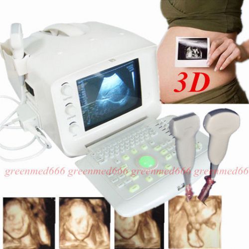 Ce 3d digital diagnostic ultrasound scanner machine +convex &amp; linear probe fda for sale