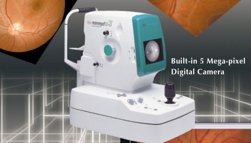 Kowa nonmyd ?-d    digital  nm retinal camera  with software notebook win7 for sale