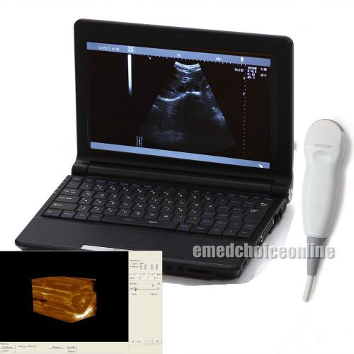 3d laptop digital ultrasound machine scanner 5.0 mhz micro-convex 3d workstation for sale