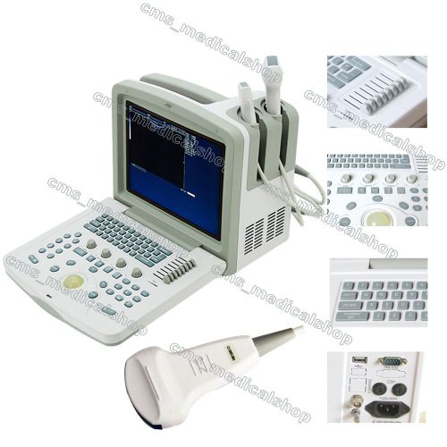 Hot sale! b-ultrasonic diagnostic system with 3.5 mhz convex probe for sale