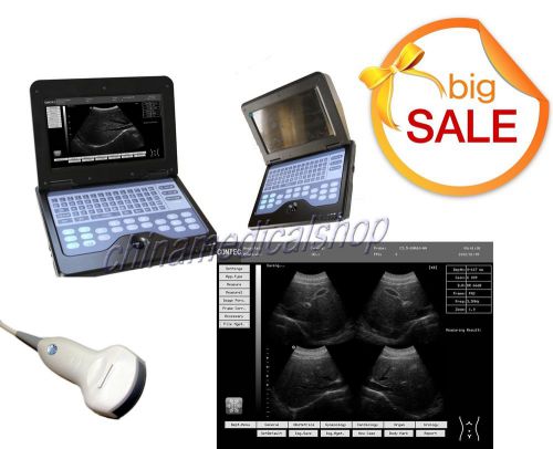 New Portable Laptop B-ultrasound Scanner Machine With Three Probes for human use