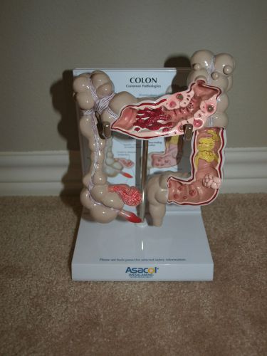 COLON large intestine anatomic / display model with stand depicting pathology