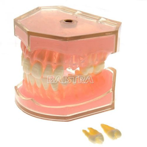 1 Pc Dental Standard teeth Tooth Study Model removable  #4004