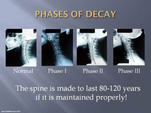 THE CHIROPRACTIC REPORT OF FINDINGS POWERPOINT LECTURE! - SEE300AWEEK