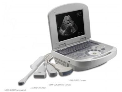 Qualified Notebook Ultrasound Scanner with Multi-Stage Focus Choice